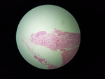 MISSING THUMBNAIL